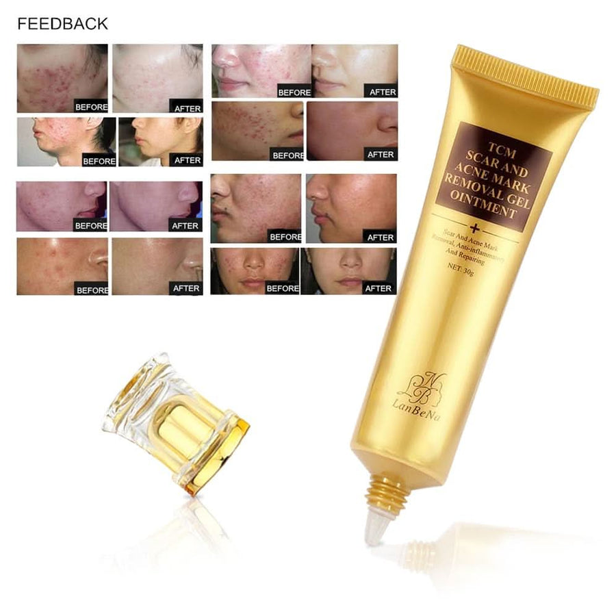 Scar Removal Cream - TCM Scar Cream for Surgical Scars, Acne Skin Care Cream, Acne Treatment Cream for Scars, Burns, Stretch Marks, Acne Spots - Sccoti