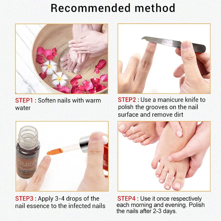 Lanbena Nail Repair Essence, Fingernail & Toenail Repair Nail Treatment 0.5fl.oz - Sccoti