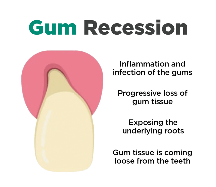 JaySuing™ Therapeutic Gel for Gum Relief - Sccoti