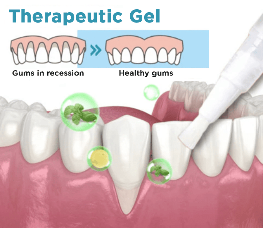JaySuing™ Therapeutic Gel for Gum Relief - Sccoti
