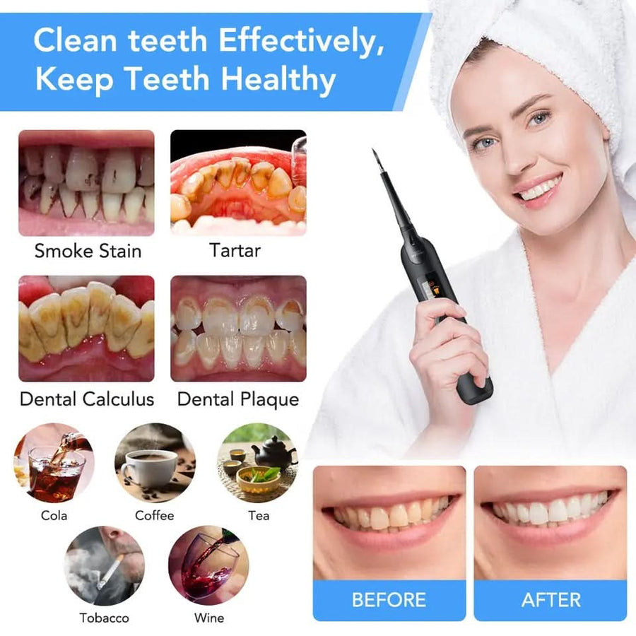 Teeth plaque remover - Sccoti